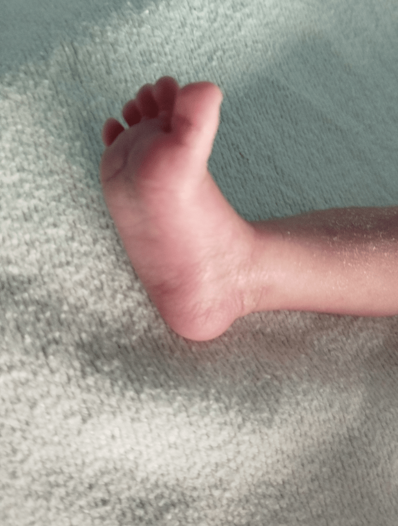 pied bien ouvert après une séance de réflexologie bébé 